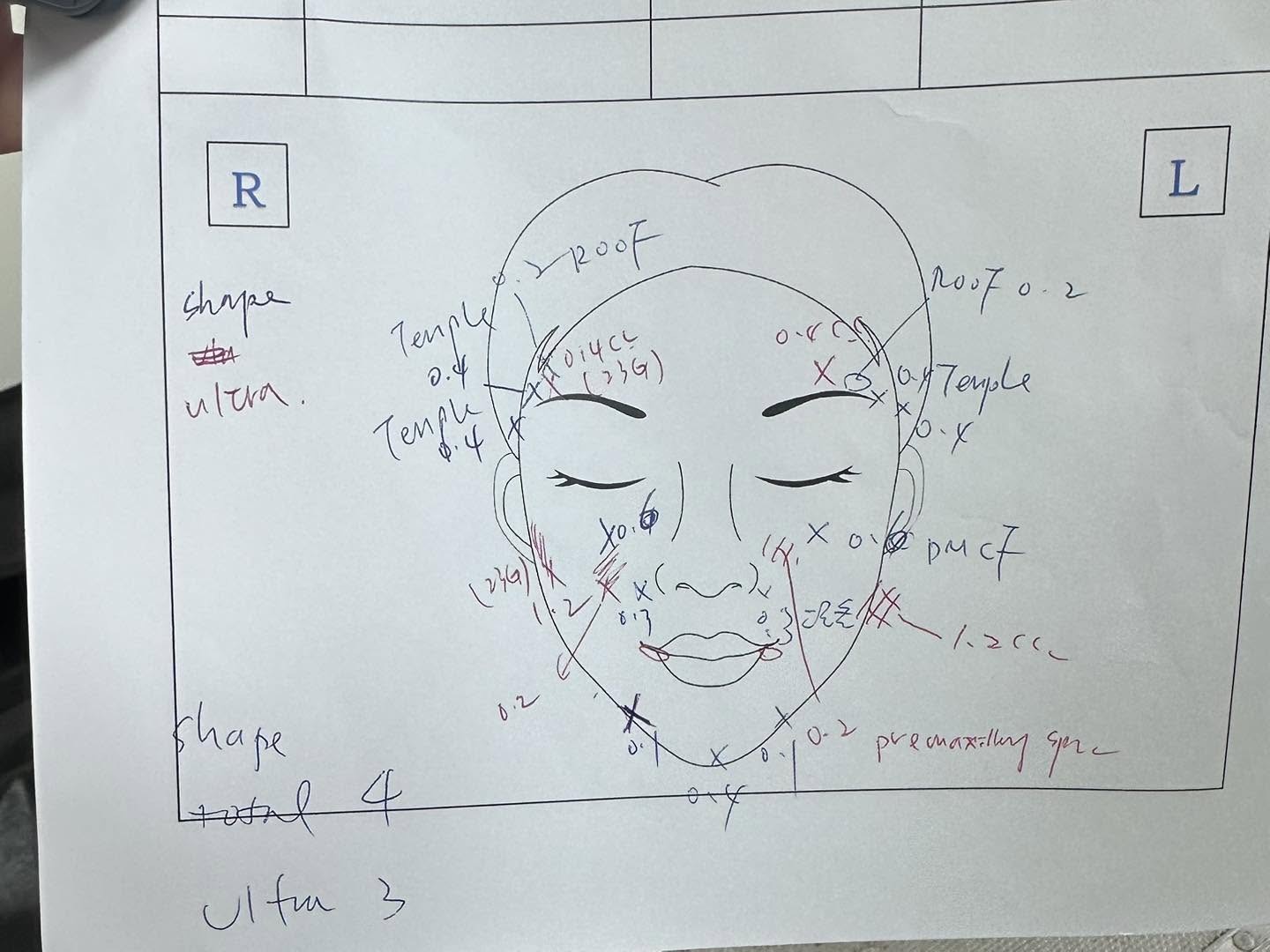 現場治療計畫手稿，標示各部位注射劑量