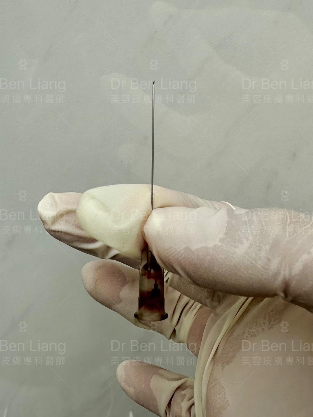 TSK 27G 細鈍針 cannula 特寫，Dr Ben Liang 微整注射工具展示
