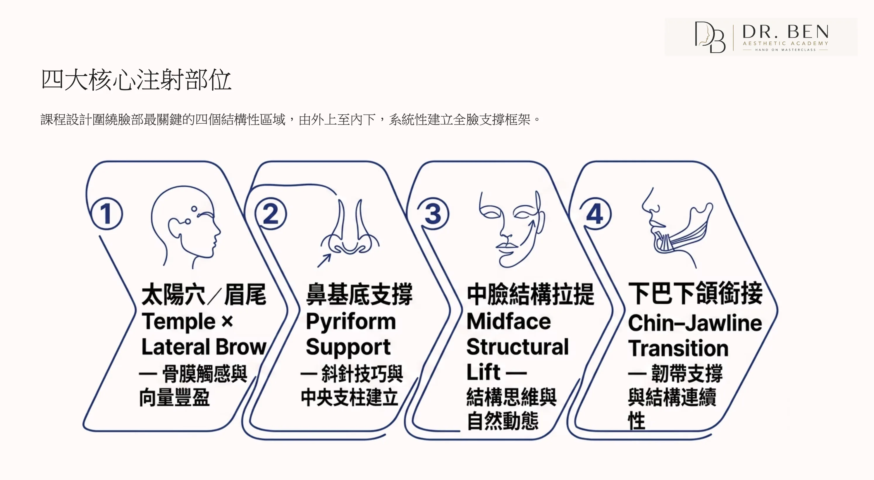 手把手尖針班四大核心注射部位：太陽穴眉尾、鼻基底、中臉結構拉提、下巴下頜銜接
