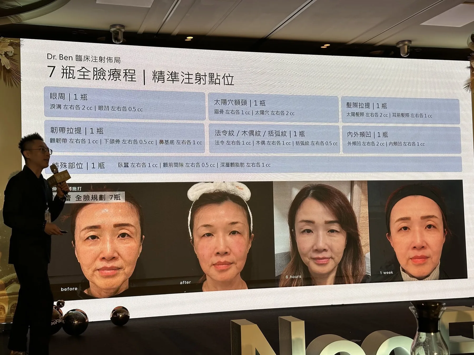 NeoFilera 七瓶全臉療程實錄與結構注射點位