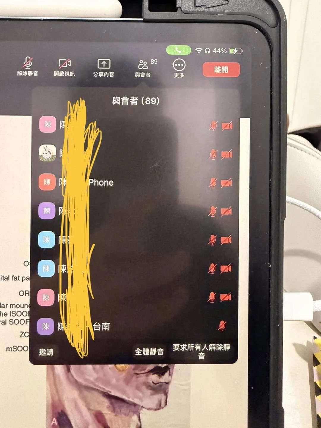 淚溝與中臉脂肪層次課程筆記示意
