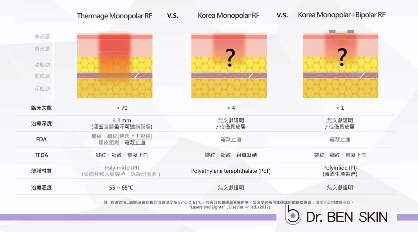 Thermage Monopolar RF 與其他電波層次比較圖